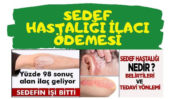 SEDEF HASTALIĞI İLACI TEDAVİ KREMİ